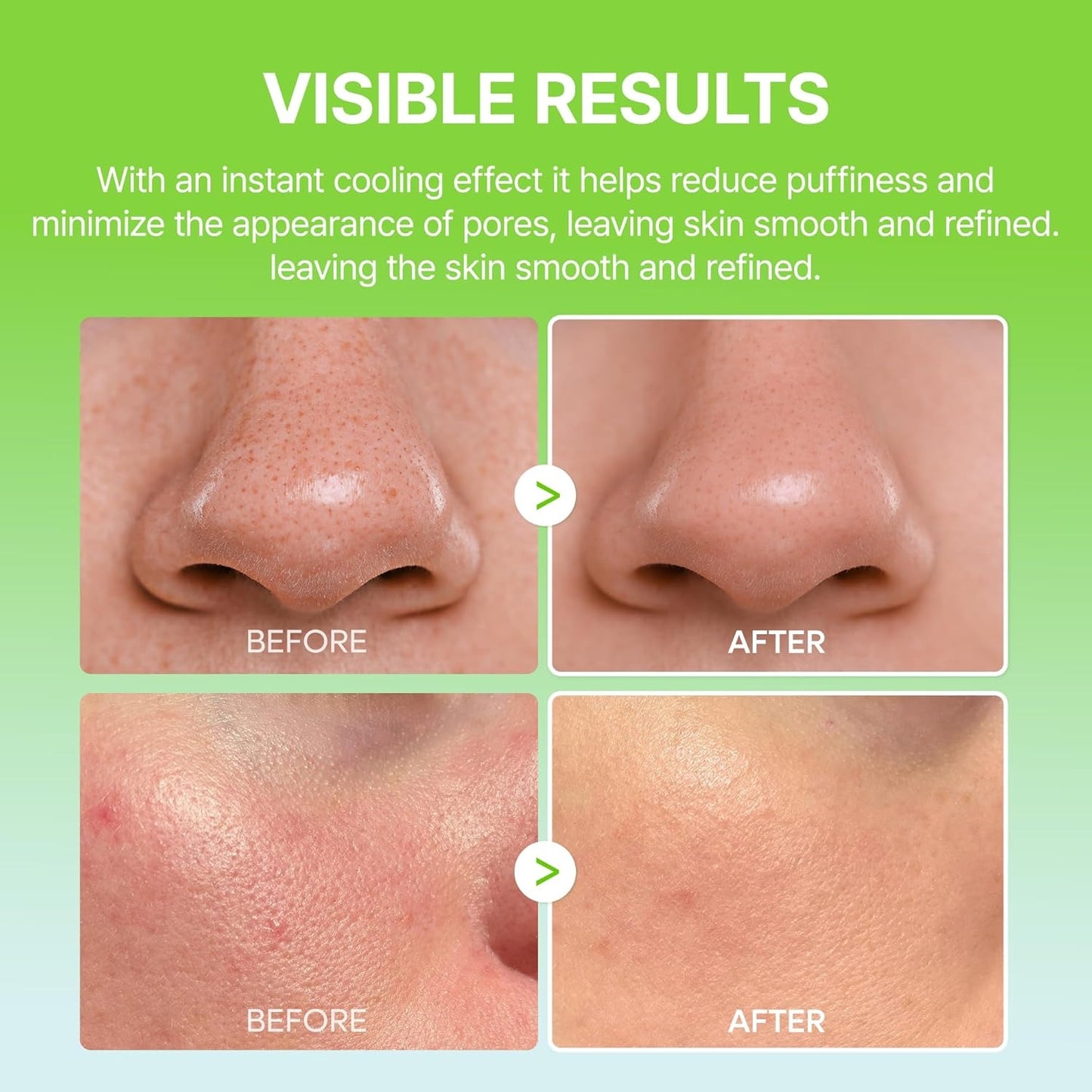 CACTOX PORE RELIEF: Instantly Tighten Pores & Reduce Puffiness in Seconds