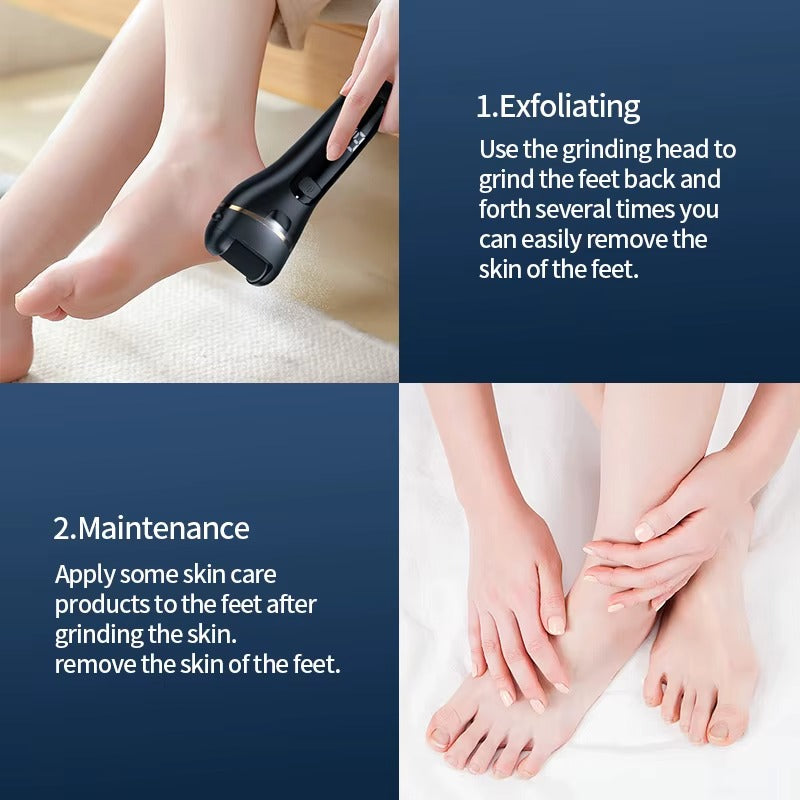 Electric Callus Remover Pedicure Kit For Smooth Feet