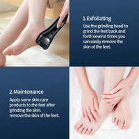 Electric Callus Remover Pedicure Kit For Smooth Feet